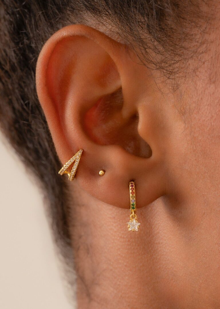 Aretes